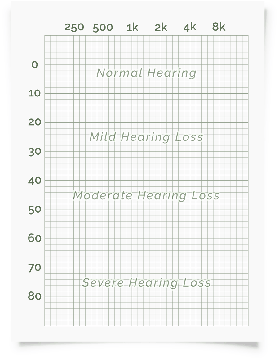 Online Hearing Test Audiogram Printout